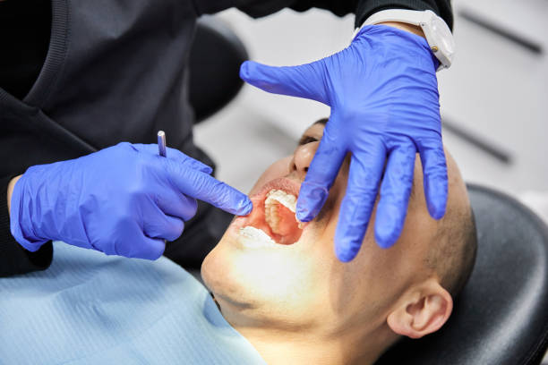 Best Emergency Dental Care for Broken or Chipped Teeth in Garden Plain, KS